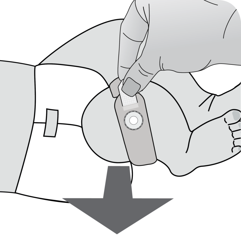 NonAdhesive Wrap Instructions Sentec